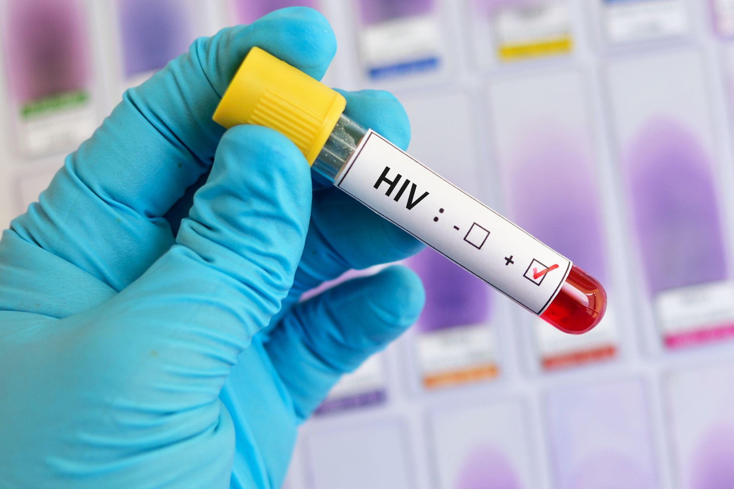 Students Affected With HIV In Tripura